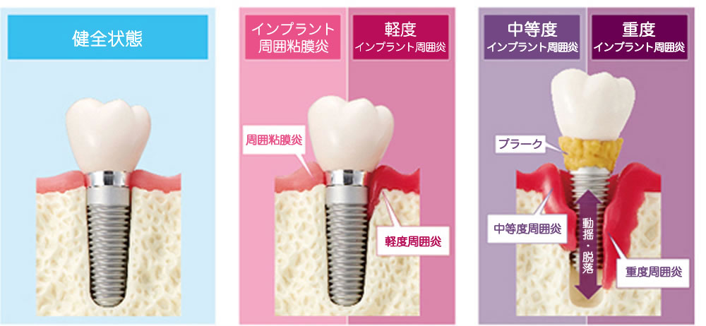 アフターケア・メインテナンス
